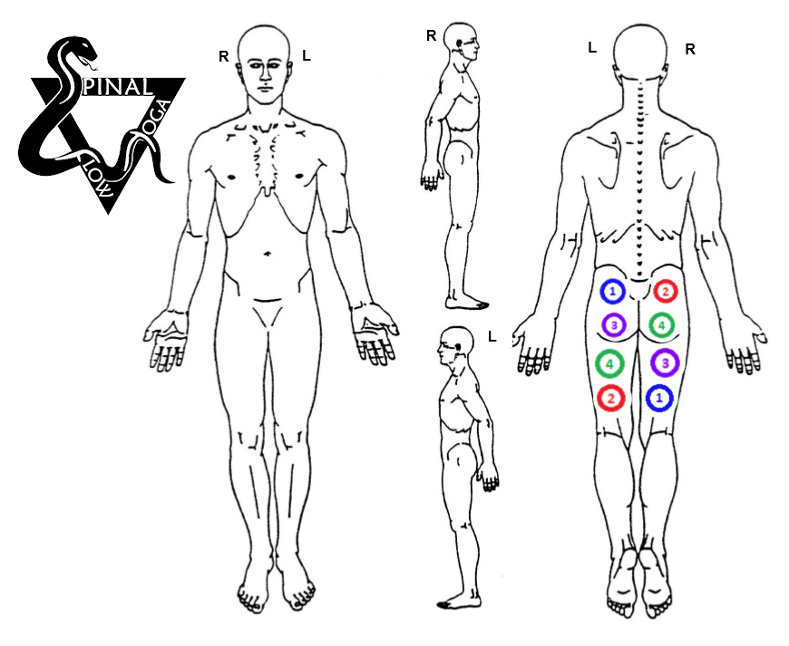 Diagram showing front, side, and back views of a human body with marked areas on the right thigh.